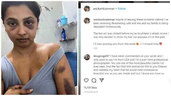 Tamil actress Anicka Vikraman was brutally beaten by her ex boyfriend Anoop Pillai