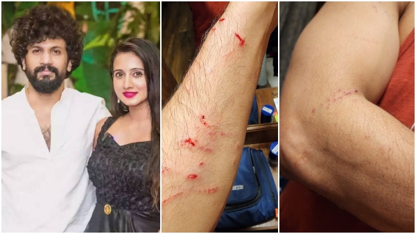 Harshika Poonacha Bhuvan Ponnanna Attacked by thugs in Bengaluru Frazer Town