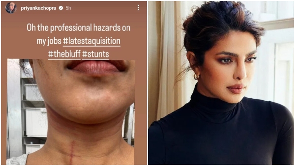 Priyanka Chopra sustains injury during filming of The Bluff