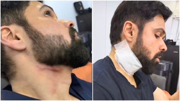 Bollywood Actor Emraan Hashmi Sustains Injury on the Set of Goodachari 2 in Hyderabad