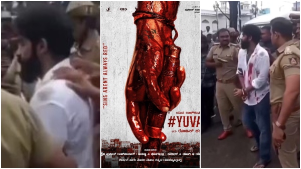 Yuva 02 Yuva rajkumar s Blood-stained Face Shocks His Fans here is truth