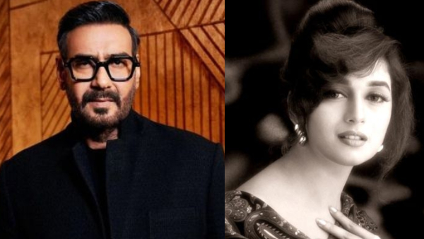 Once Ajay Devgn lost his senses in the beauty of Madhuri Dixit and burnt his face with cigarette