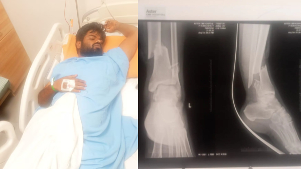 from-controversy-to-car-crash-rakshak-bullets-reckless-driving-breaks-bikers-leg
