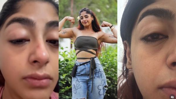 broken-tooth-swollen-face-splitsvilla-s-preet-singh-assaulted-influencer-s-friend-mumbai-club