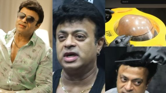 പല താരങ്ങൾക്കും ഇല്ലാത്ത ധൈര്യം...; വർഷങ്ങളായി കഷണ്ടിയുണ്ട്, മുടി തിരിച്ച് വരുമെന്ന് കരുതി ഷേവ് ചെയ്തു; റിയാസ്