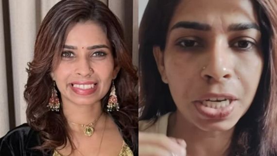 ആസ്വദിച്ച് കണ്ടശേഷം ഏതോ ഒരുത്തൻ ലീക്ക് ആക്കിയതാണ്, അതൊരു ലൈവ് വീഡിയോയായിരുന്നു, ഇനിയും ഇടും; രേണു