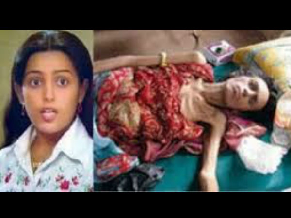 ഉറുമ്പരിച്ച ശരീരം കണ്ടെത്തുമ്പോള്‍