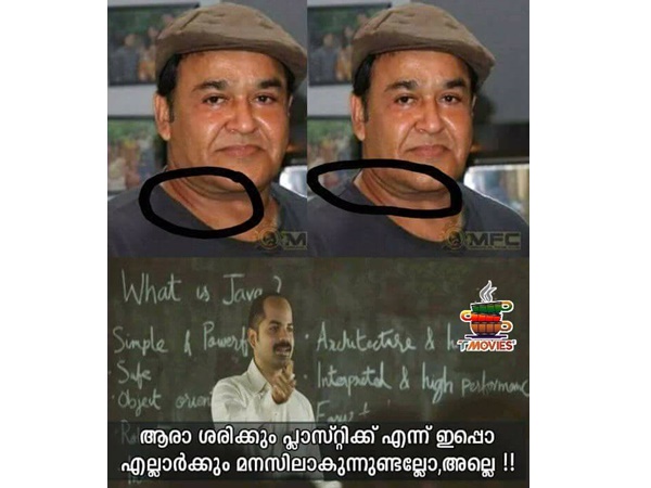  പ്ലാസ്റ്റിക് സര്‍ജറിയോ?