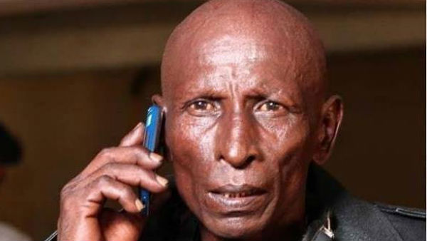 തലയിലുണ്ടായ ചെറിയ മുറിവ്