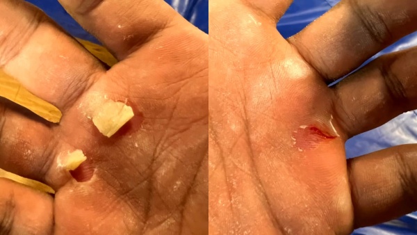 വിമാനത്തിൽവെച്ചുണ്ടായ അനുഭവം