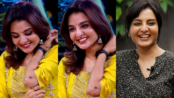 അയാൾ അയേൺ ബോക്സ് വെച്ച് അടിച്ചപ്പോൾ തലയ്ക്ക് പരിക്കേറ്റ് രക്തം വന്നു
