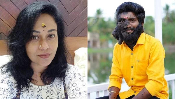 ആദ്യമായി കാണുമ്പോൾ വേദനയിലും ചിരിയോടെയാണ് സ്വീകരിച്ചത് 