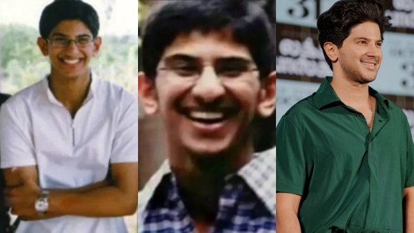 Dulquer Salmaan facial surgeries Dulquer Salmaan facial surgeries