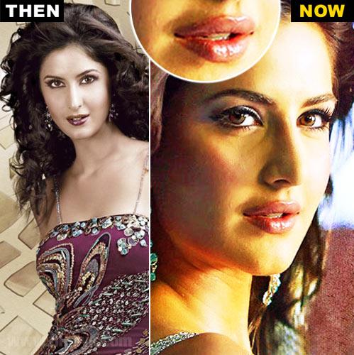 Bollywood Beauties and their Surgeries