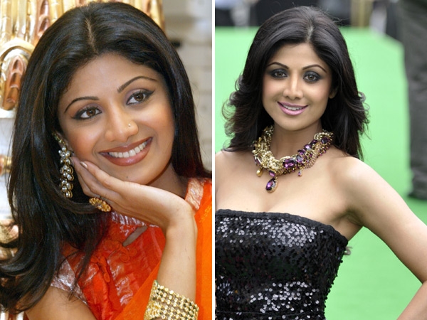 Bollywood Beauties and their Surgeries