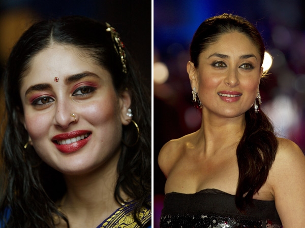 Bollywood Beauties and their Surgeries