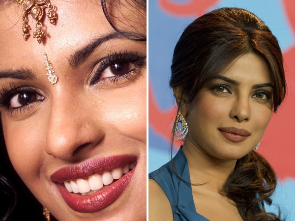 Bollywood Beauties and their Surgeries