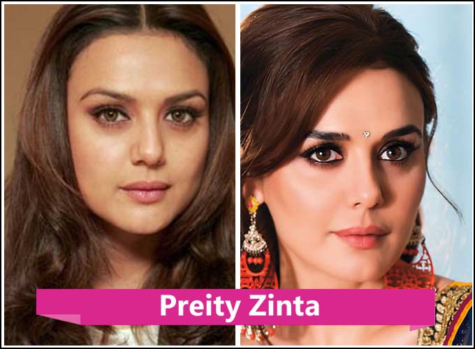 Kollywood Actress Plastic Surgery Before And After