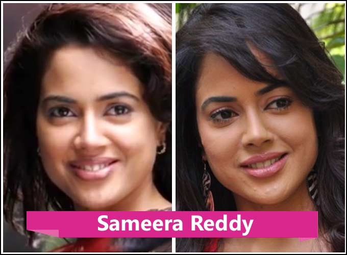 Kollywood Actress Plastic Surgery Before And After