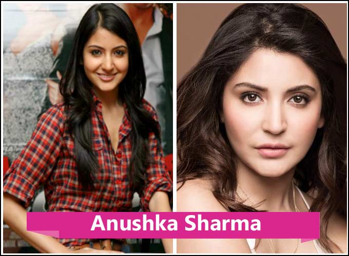 Kollywood Actress Plastic Surgery Before And After