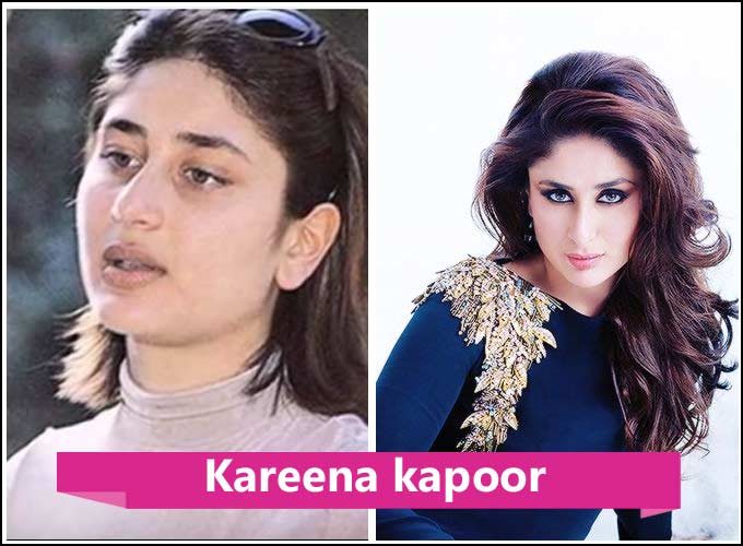 Kollywood Actress Plastic Surgery Before And After