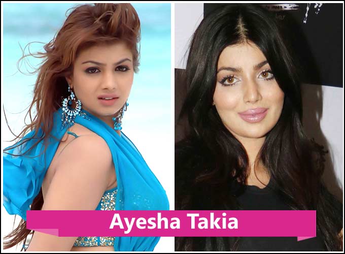 Kollywood Actress Plastic Surgery Before And After
