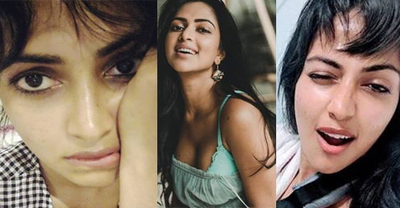 Amala Paul's Latest Instagram Photos With Broken Hand
