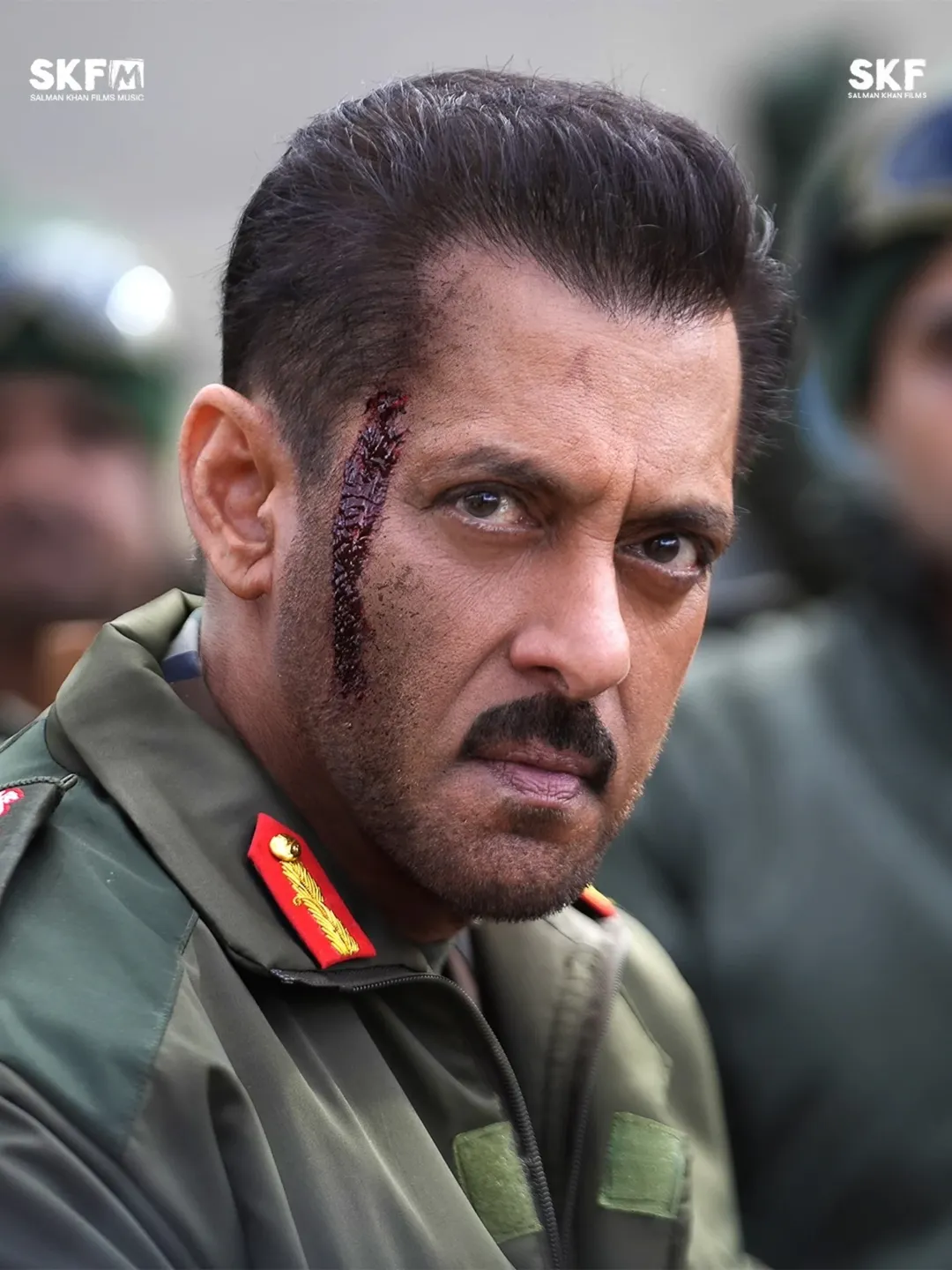 Salman Khan injured during battle scene
