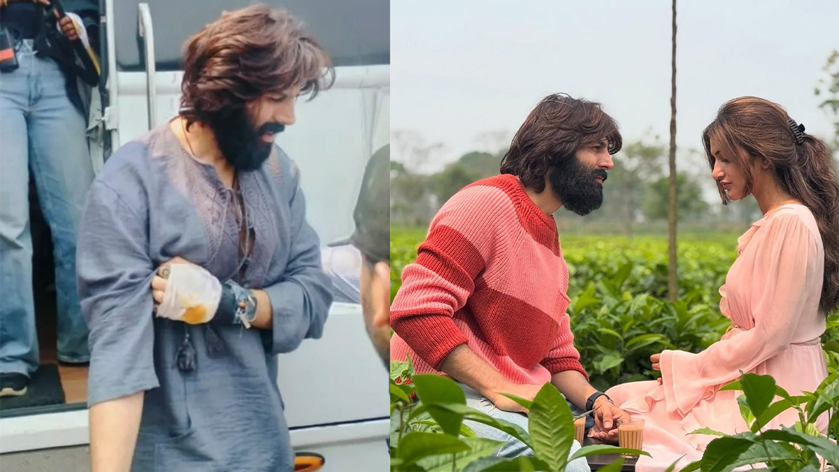 Kartik Aaryan Injured On Anurag Basu's Film Set: See Viral PIC - Filmibeat