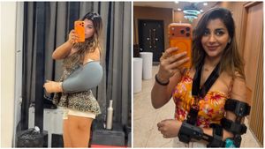 விளையாட்டு வினையா போச்சு.. கையில் எலும்பு முறிவு.. புலம்பும் யாஷிகா ஆனந்த்!