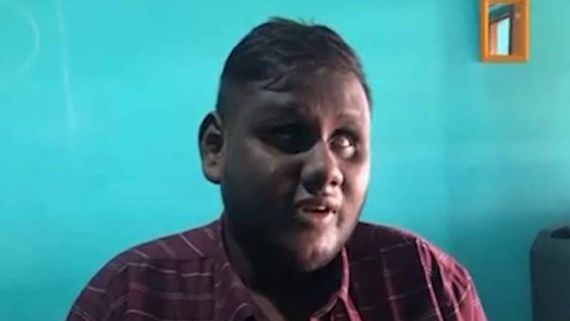 விபத்தில் முறிந்த கை எலும்பு.. இனி வாசிக்கவே முடியாதா? கலங்கிய பாடகர்!