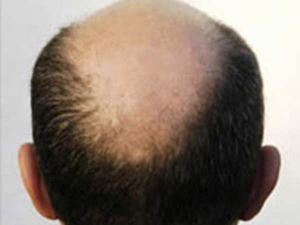 Heroine starts selling wigs Heroine starts selling wigs