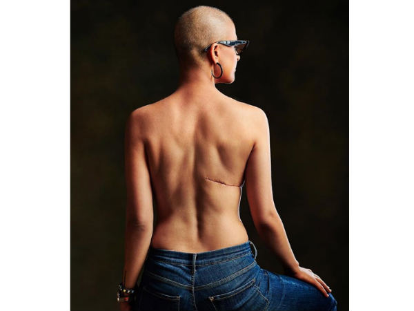 Tahira Kashyaps bold move Tahira Kashyaps bold move