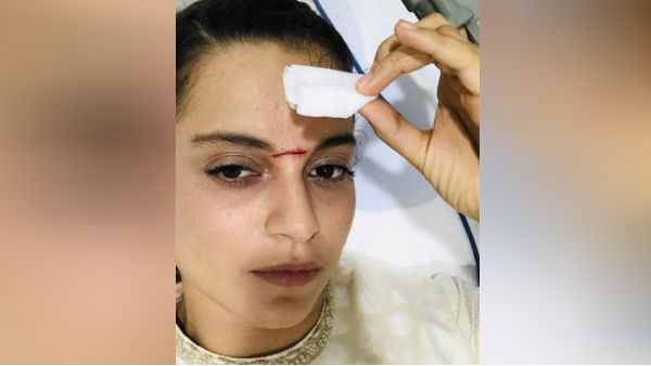 நெற்றியில் வெட்டுக்காயம் 