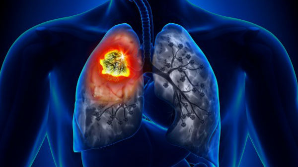 உயிர் பிரிந்தது 