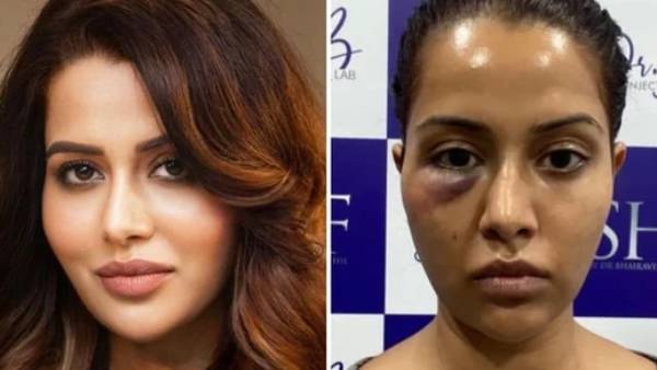 ரூ.1 கோடி நஷ்ட ஈடு ரூ.1 கோடி நஷ்ட ஈடு