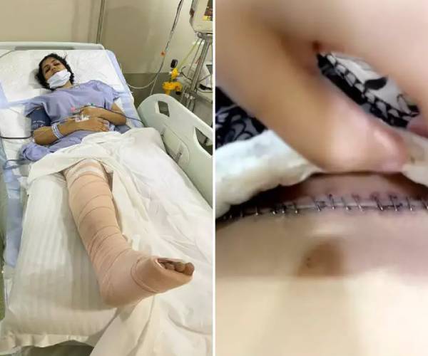 ஏராளமான தையல்