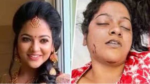 சித்ரா உடம்பில் காயங்கள் நகக்கீறல்கள்