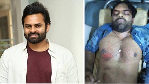 தலையில் அடி இல்லை