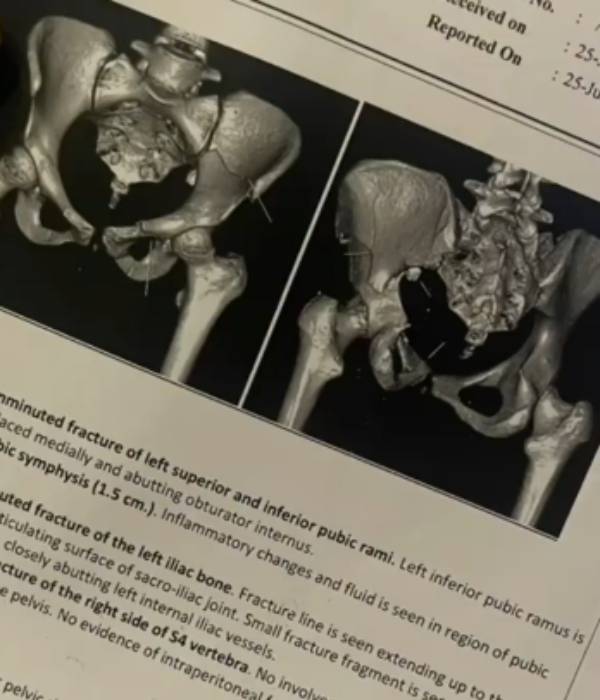 குழந்தையை போல் ஒவ்வொரு அடியாக 