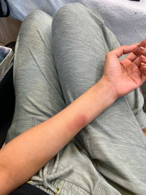 காயம் பட்ட போட்டோ..