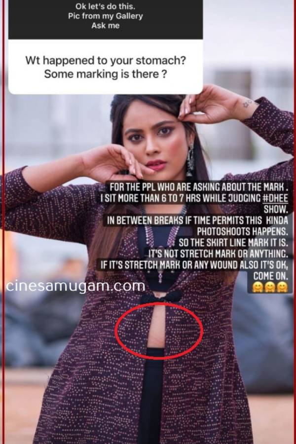 வயிற்றில் என்ன தழும்பு