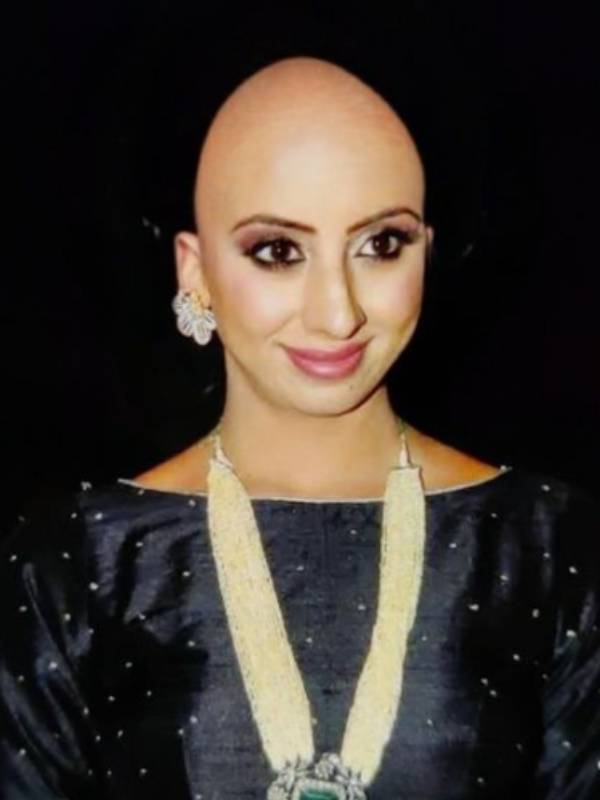 மொட்டைதலையுடன்