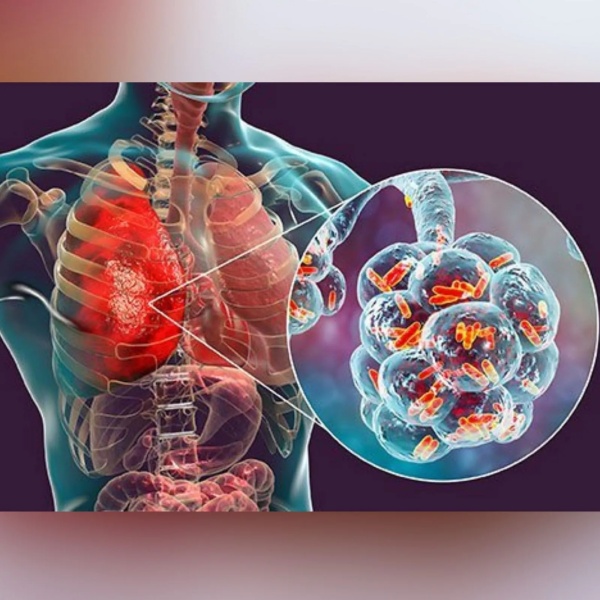 பொதுவான ஒன்றல்ல