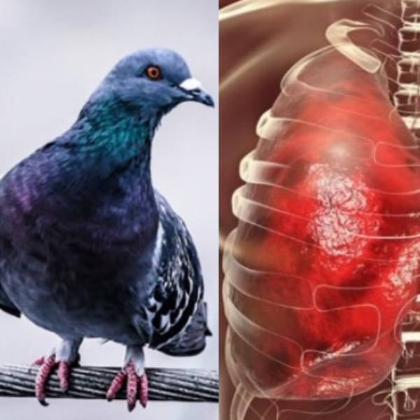 ஹிஸ்டோபிளாஸ்மோசிஸ்