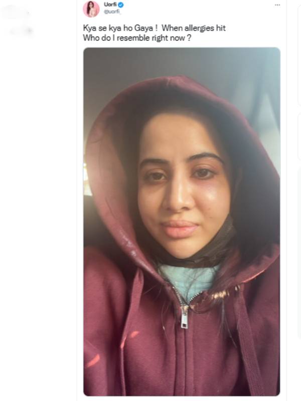 முகம் வீங்கிப் போச்சு முகம் வீங்கிப் போச்சு