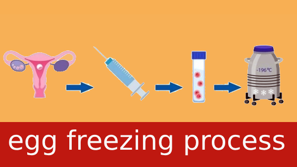 Ram Charan wife Upasana undergoes Egg Freezing, here we look about the cost and process