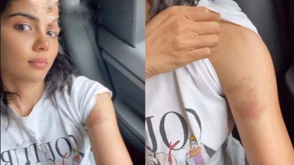 In Antony movie shooting Actress Kalyani priyadarshan met an accident 