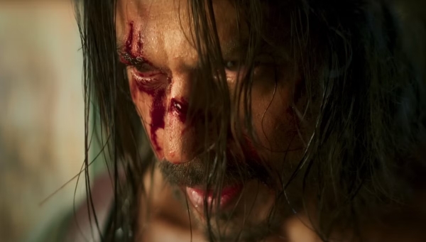 Shah Rukh Khan met accident and injured in nose on shooting spot and done a minor surgery