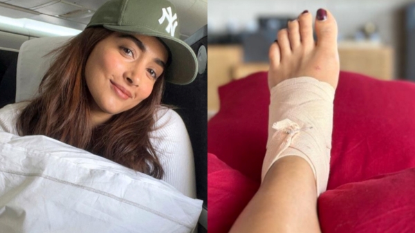 Vijay starrer Beast heroine pooja hegde surgery in leg